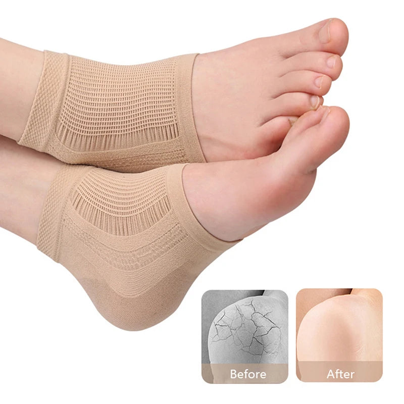2PCS Gel Silicone Heel Protector Sleeve Heel Pads