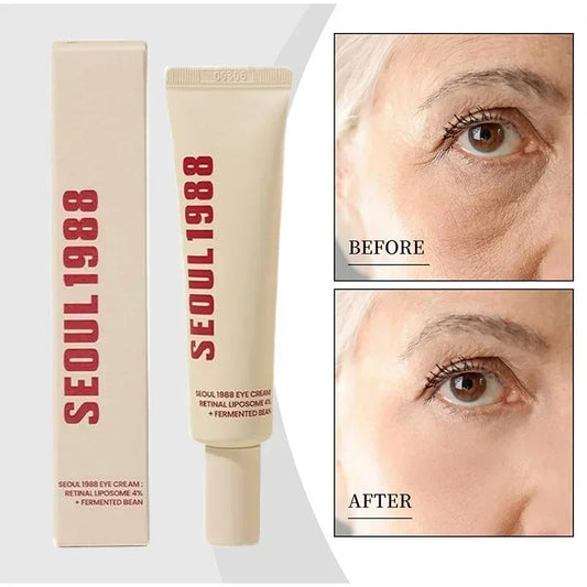 Seoul 1988 Retinol Eye Cream 4% Anti Aging Eye Treatment