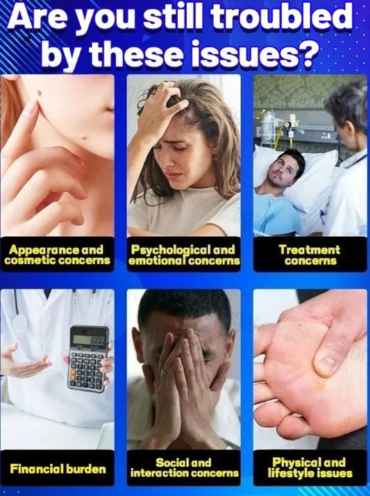 Wart Remover Pᴇɴ Efficient Removal Skin Care