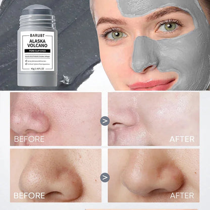 Volcano Cleansing Blackhead Remover Mask