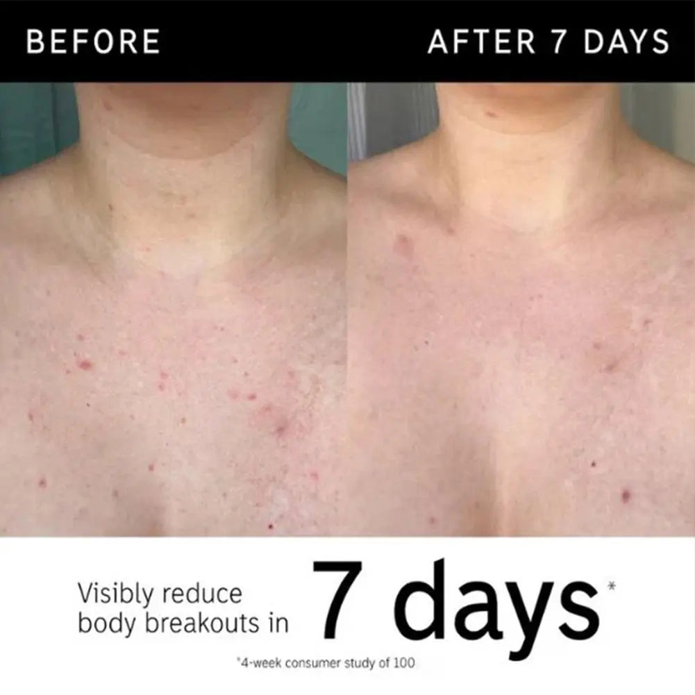 Glycolic Acid Exfoliating Body Stick Skin Brightening & Smoothing Treatment
