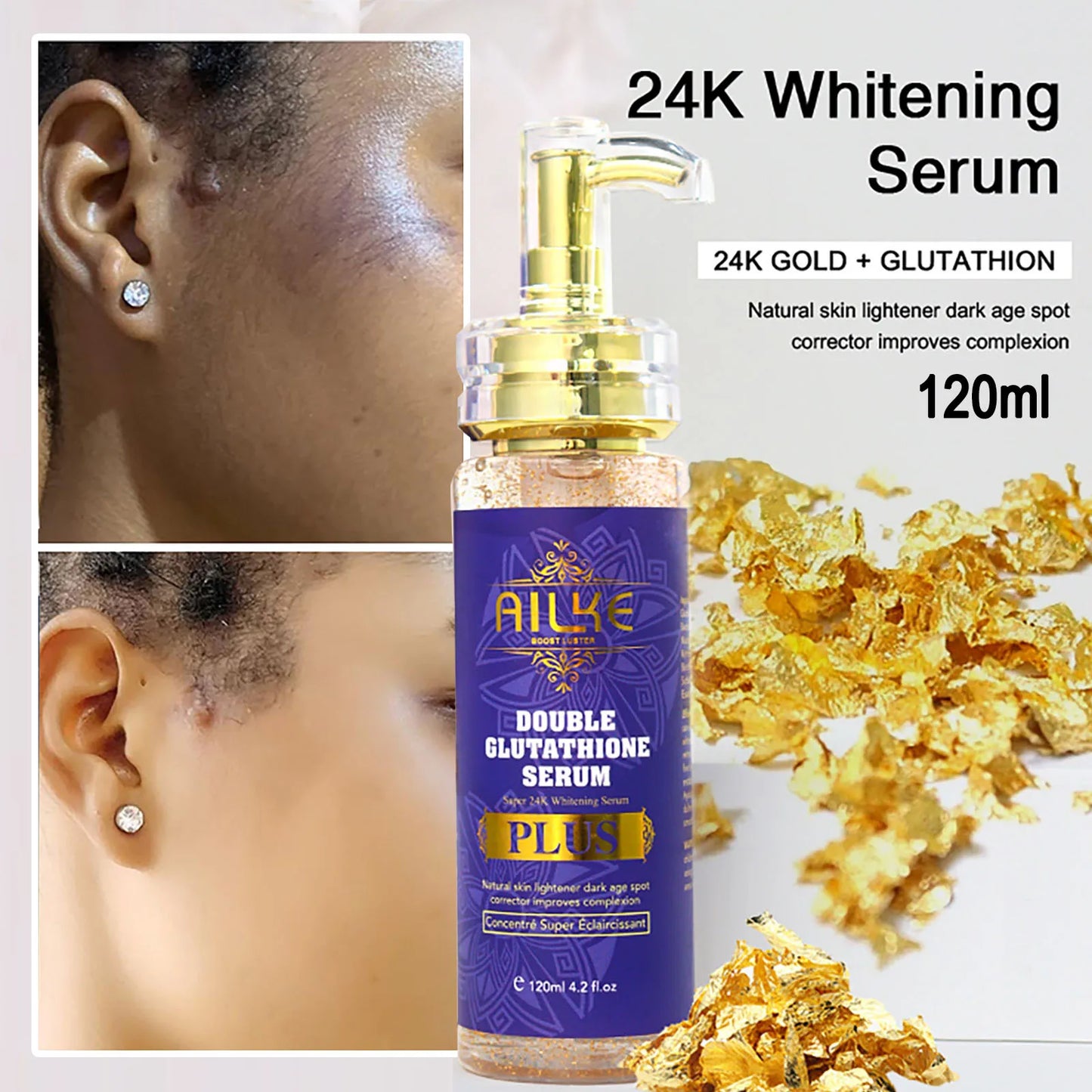 Premium Skin Lightening Cream Dark Spot