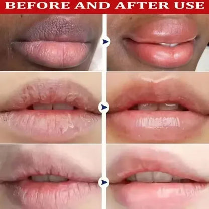 Remove Dark Lip Balm Serum Fast Lighten Lip Mask