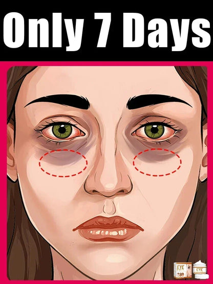 selling wrinkle removing eye cream moisturizing tool