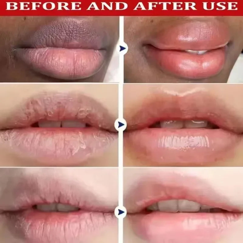 Lighten Melanin Lip Mask Remove Dark Lip Balm Serum