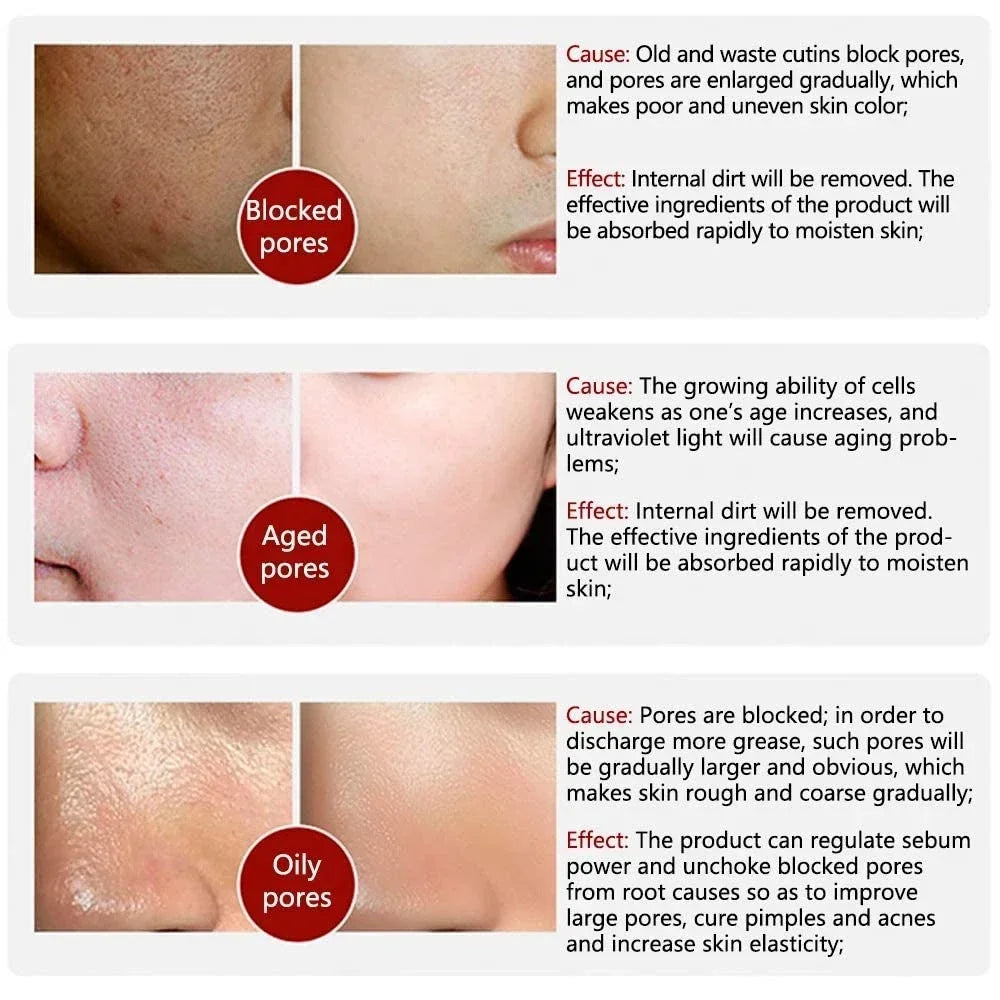 Skin Texture | Pore Refining  Brightening Serum