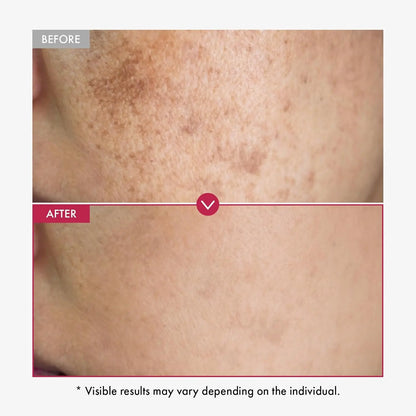 سيروم ألفا أربوتين للجسم