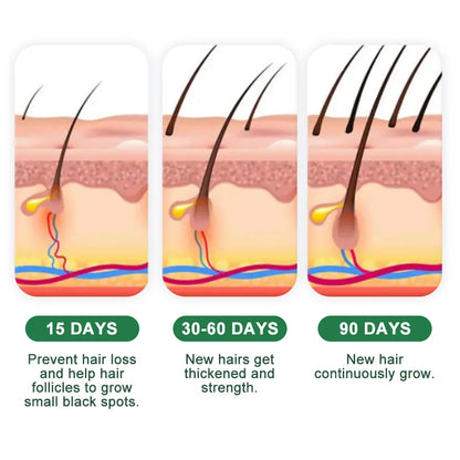 Fast Ginger Hair Growth Cream