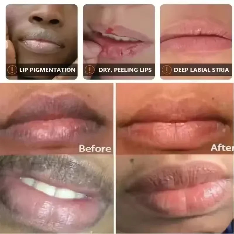 Lighten Melanin Lip Mask Remove Dark Lip Balm Serum