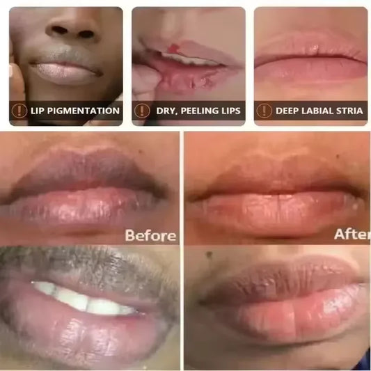 Lighten Melanin Lip Mask Remove Dark Lip Balm Serum