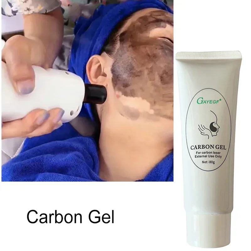 Laser Skin Peeling Carbon Cream Whitening Moisturizing Peel Deep Cleaning