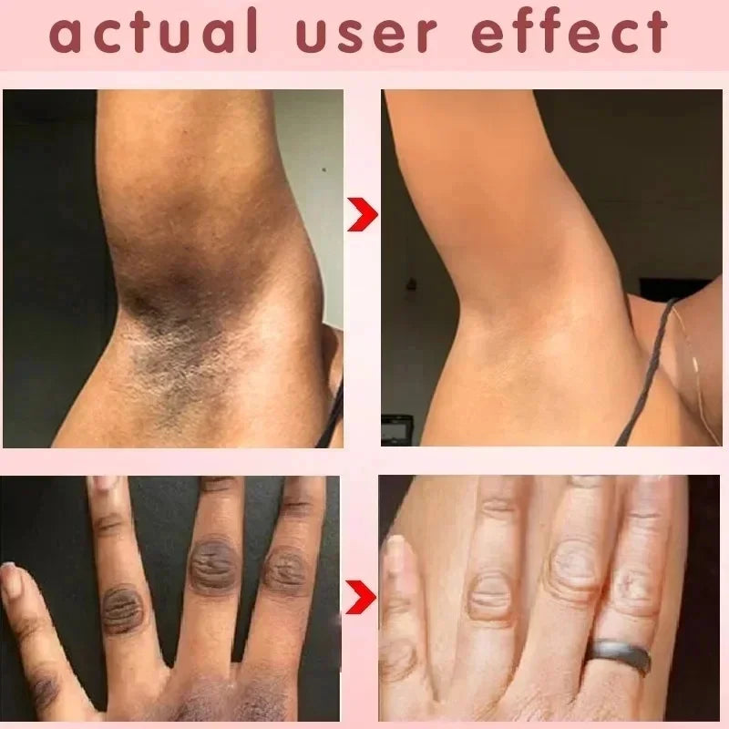 Crema blanqueadora corporal de acción rápida