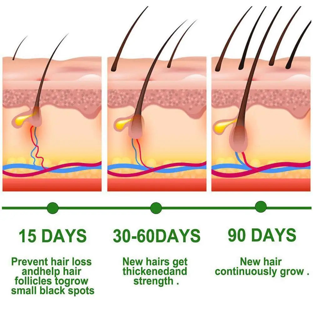 Anti-Hair Loss Serum Thinning Balding Treatment Oil