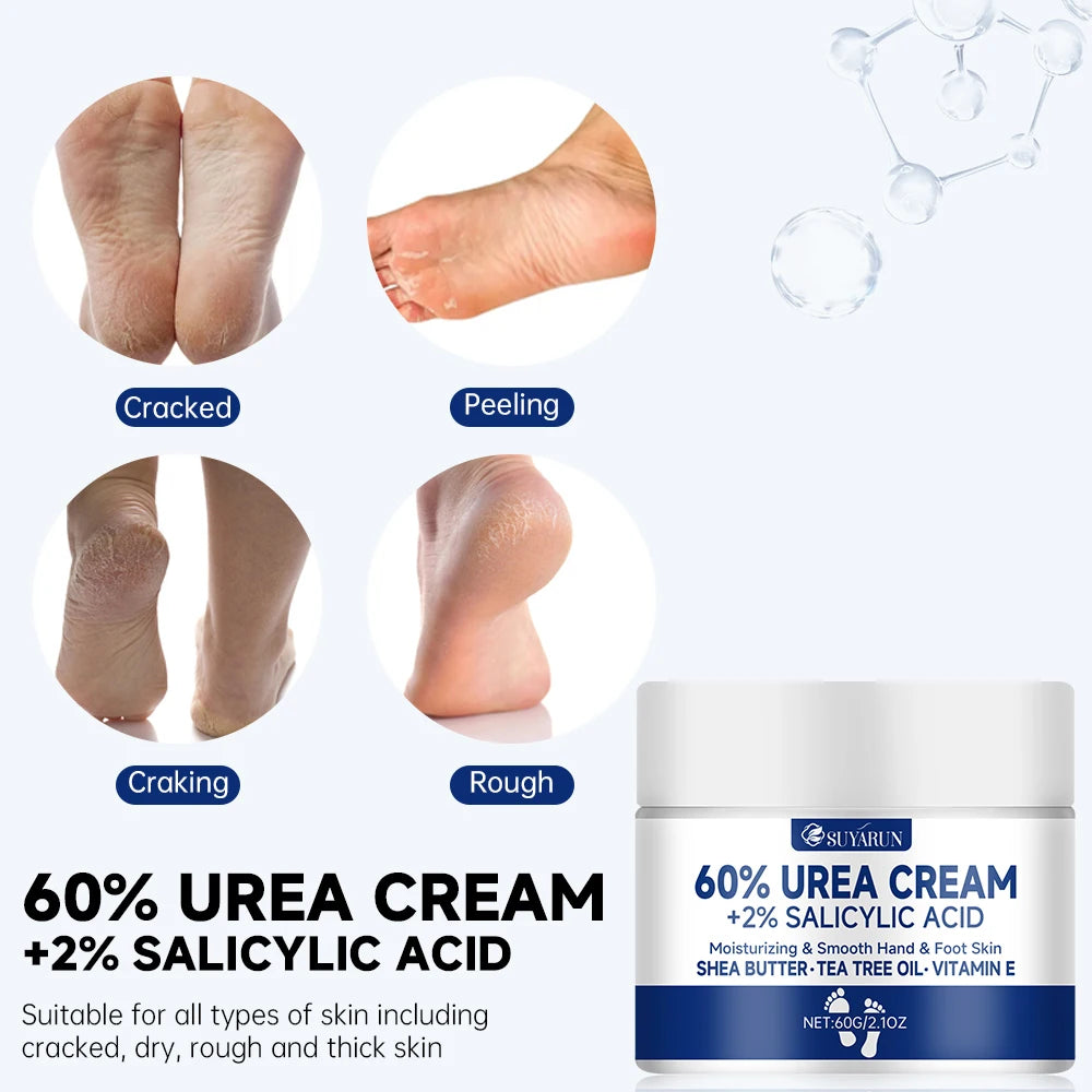 60% Urea Foot Cream for Cracked Heels