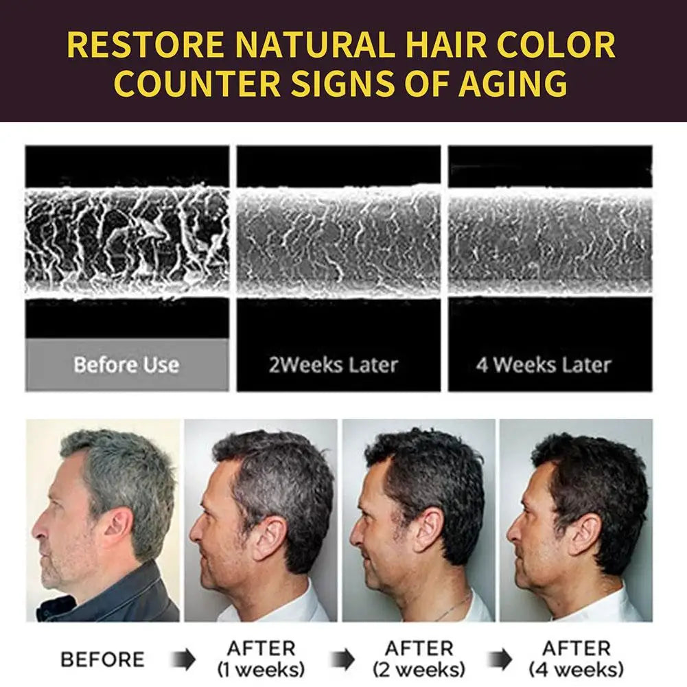 شامبو صبغ الشعر للتحكم بالزيت الرقيق