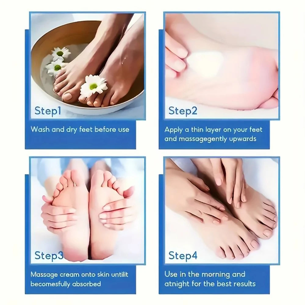 60% Urea Foot Cream for Cracked Heels