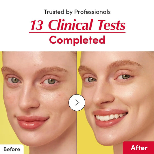 Sérum blanqueador con vitamina C para el cuidado de la piel