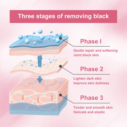 Body Whitening Cream Dark Spot