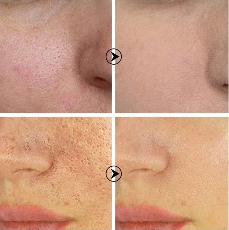 Skin Texture | Pore Refining  Brightening Serum