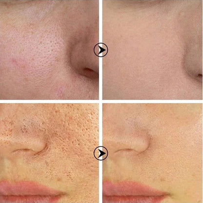 Skin Texture | Pore Refining  Brightening Serum
