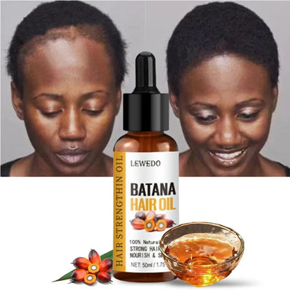 Naturals Batana Oil Fast Hair Growth f