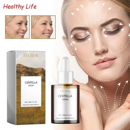 Centella Asiatica Face Serum Nourish Dry Skin