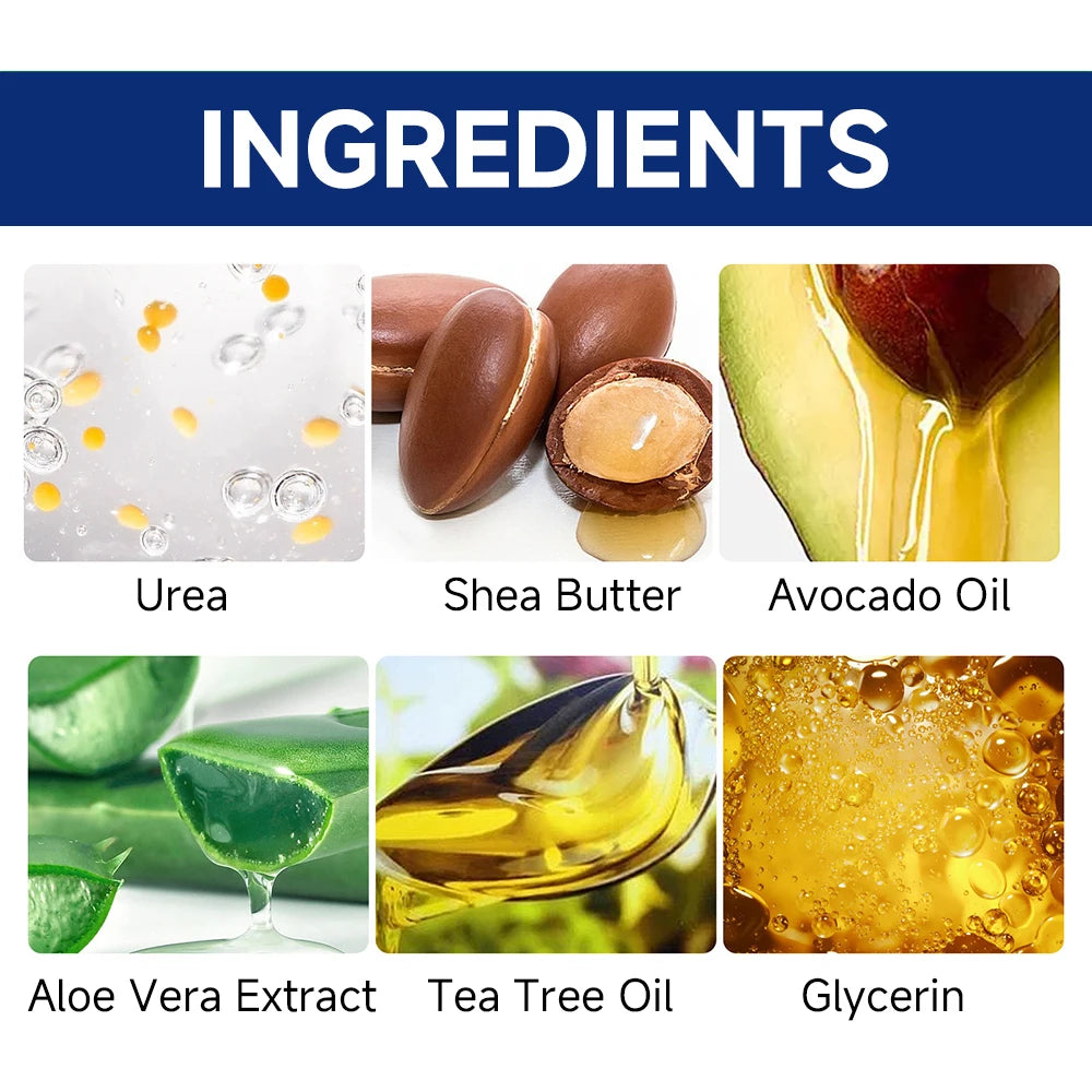 60% Urea Foot Cream for Cracked Heels