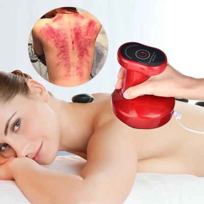 Electric Cupping Massage Anti-Cellulite Fat Burner Slimming
