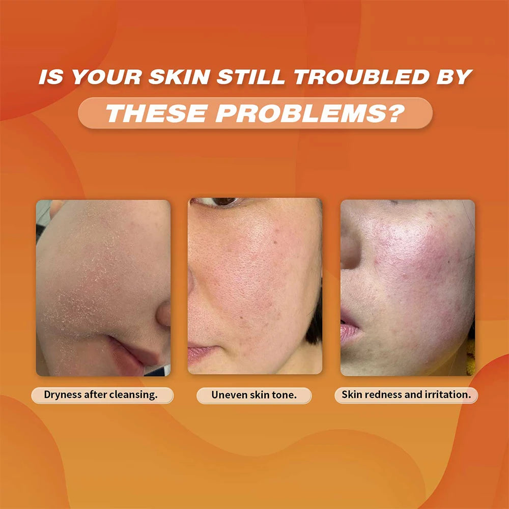 Limpiador de cúrcuma Hidrata la piel del rostro Ilumina la piel