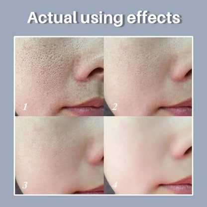 Skin Texture | Pore Refining  Brightening Serum