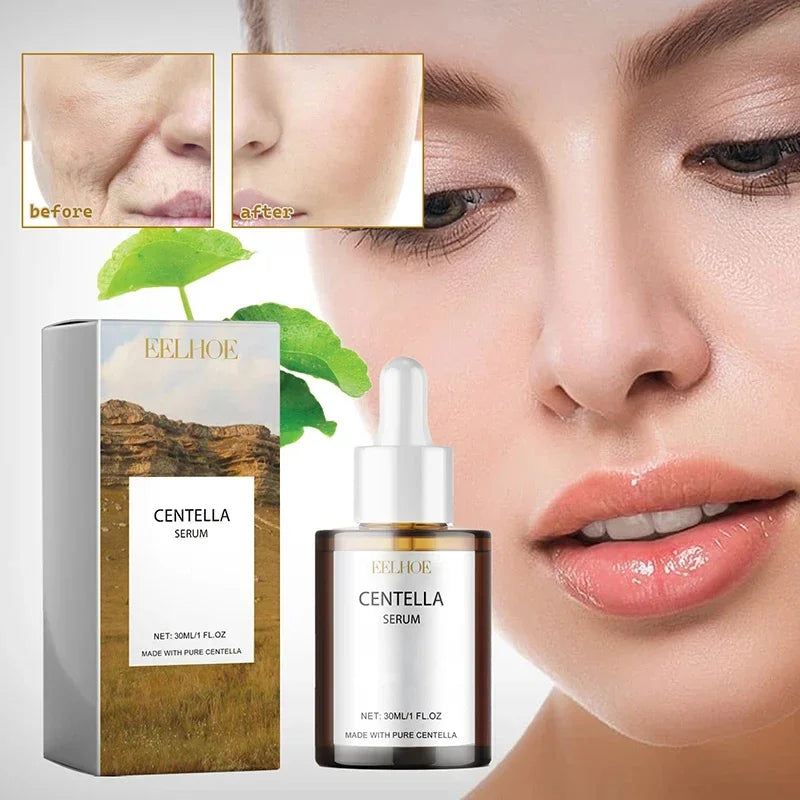 Centella Asiatica Face Serum Nourish Dry Skin