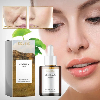Centella Asiatica Face Serum Nourish Dry Skin
